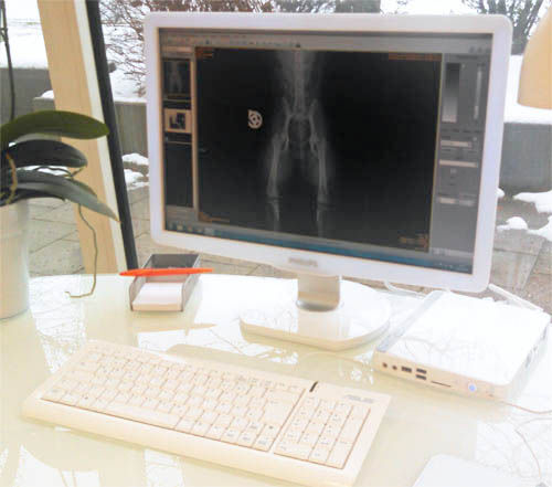 Ein Computer zeigt ein digitales Röntgenbild im modernen medizinischen Büro.